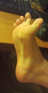 Feet and soles