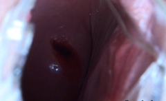 Speculum Teen Toys Pussy Before Gaping